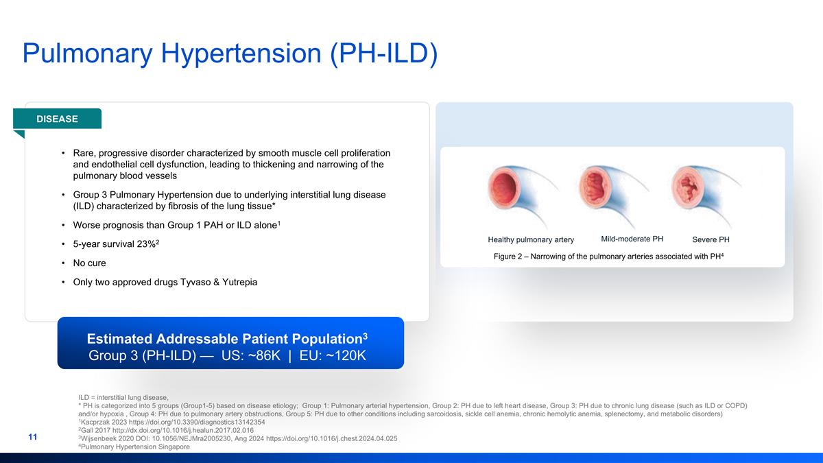 Slide 11