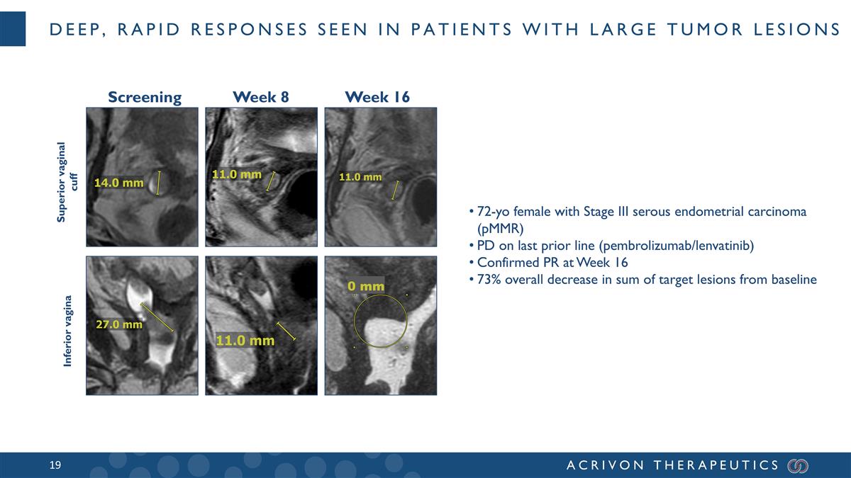 Slide 19
