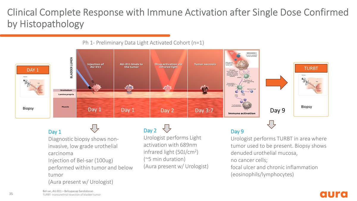 Slide 35