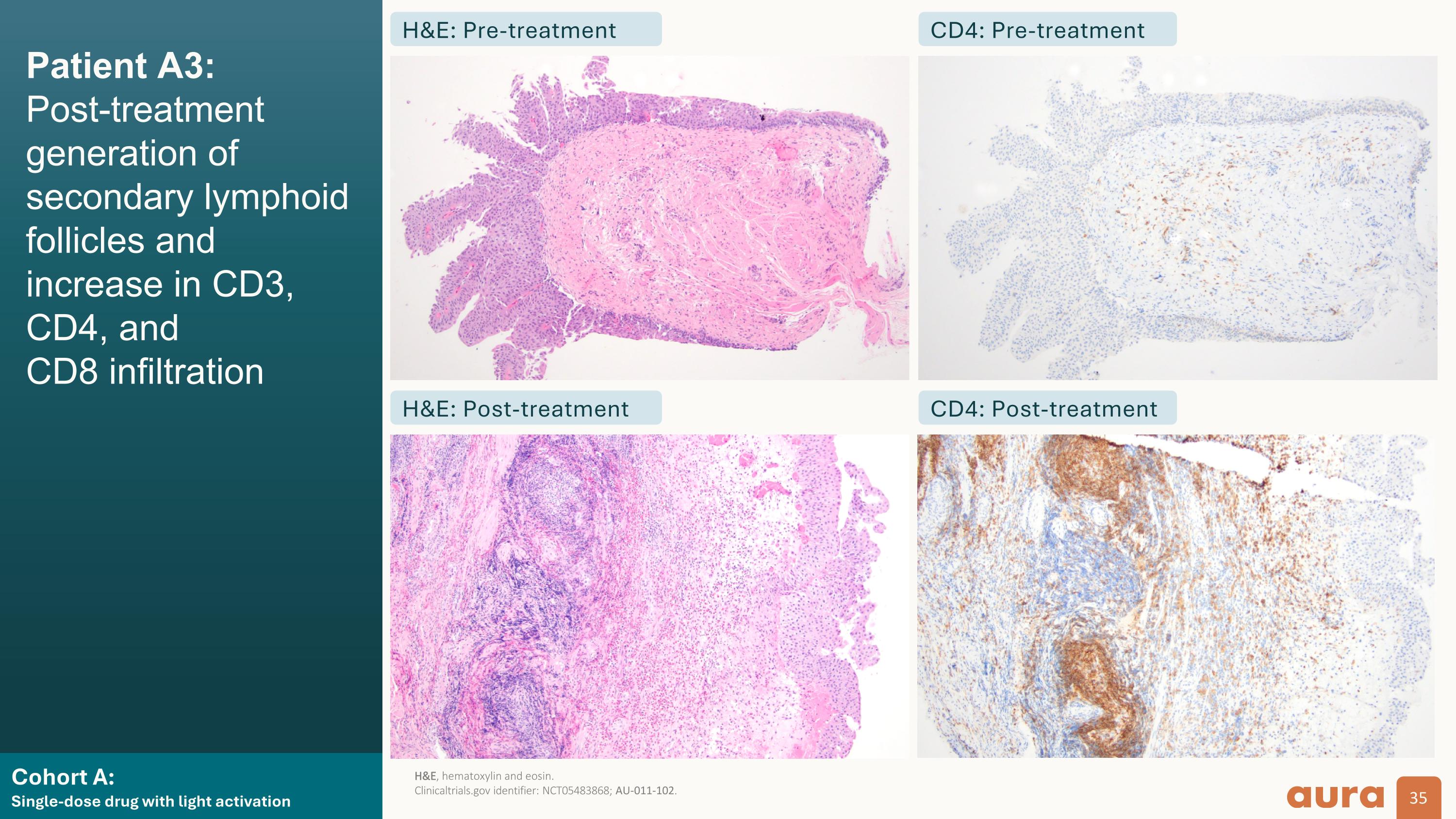 Slide 35