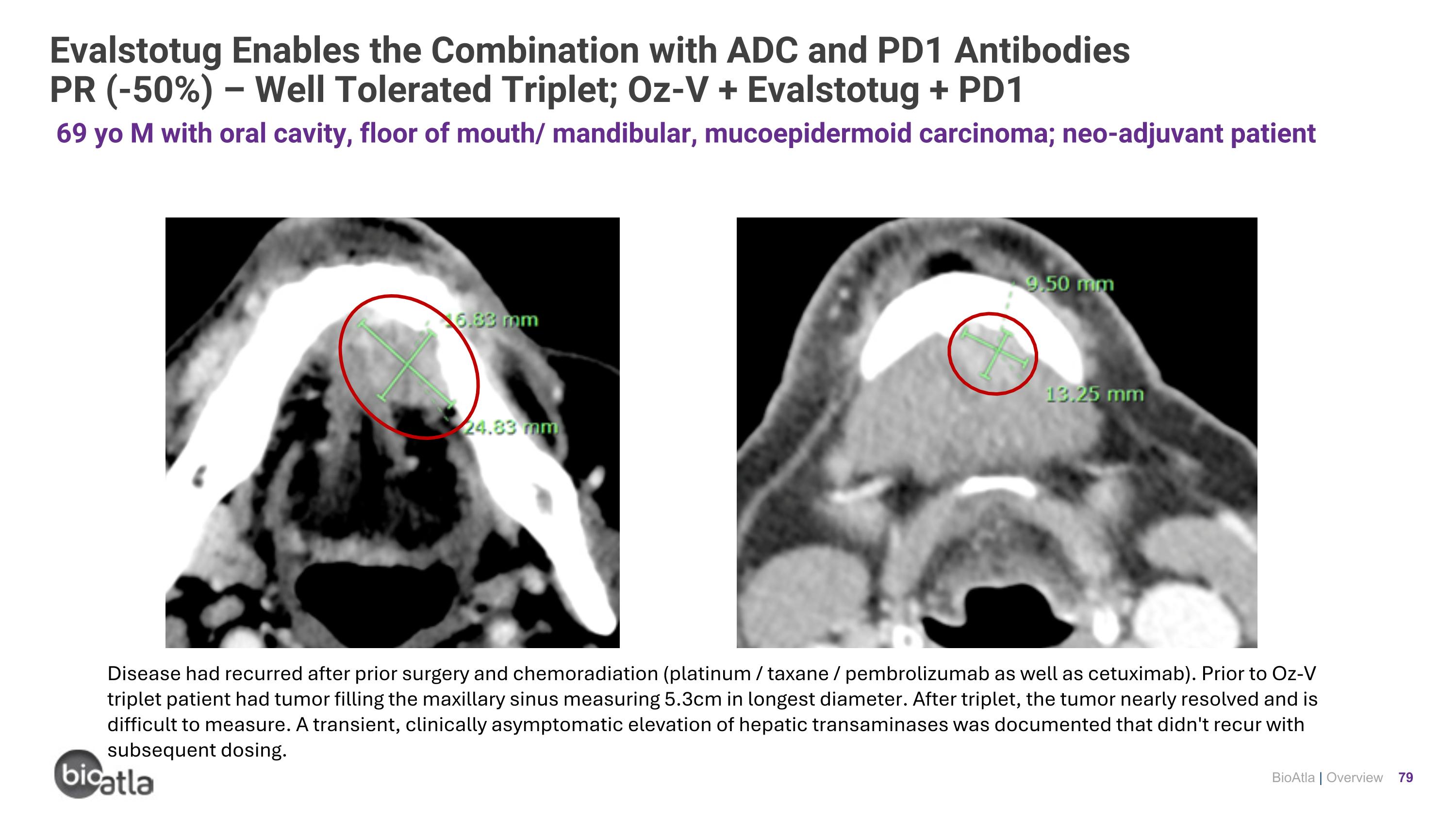 Slide 79