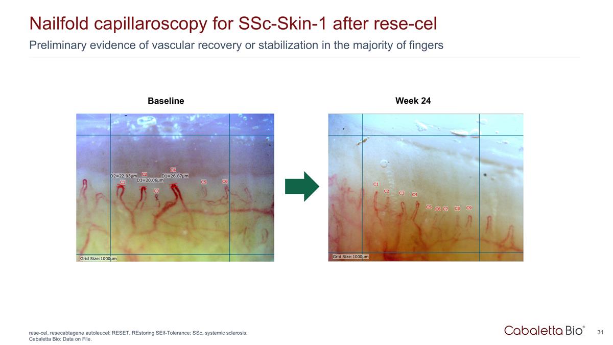 Slide 31