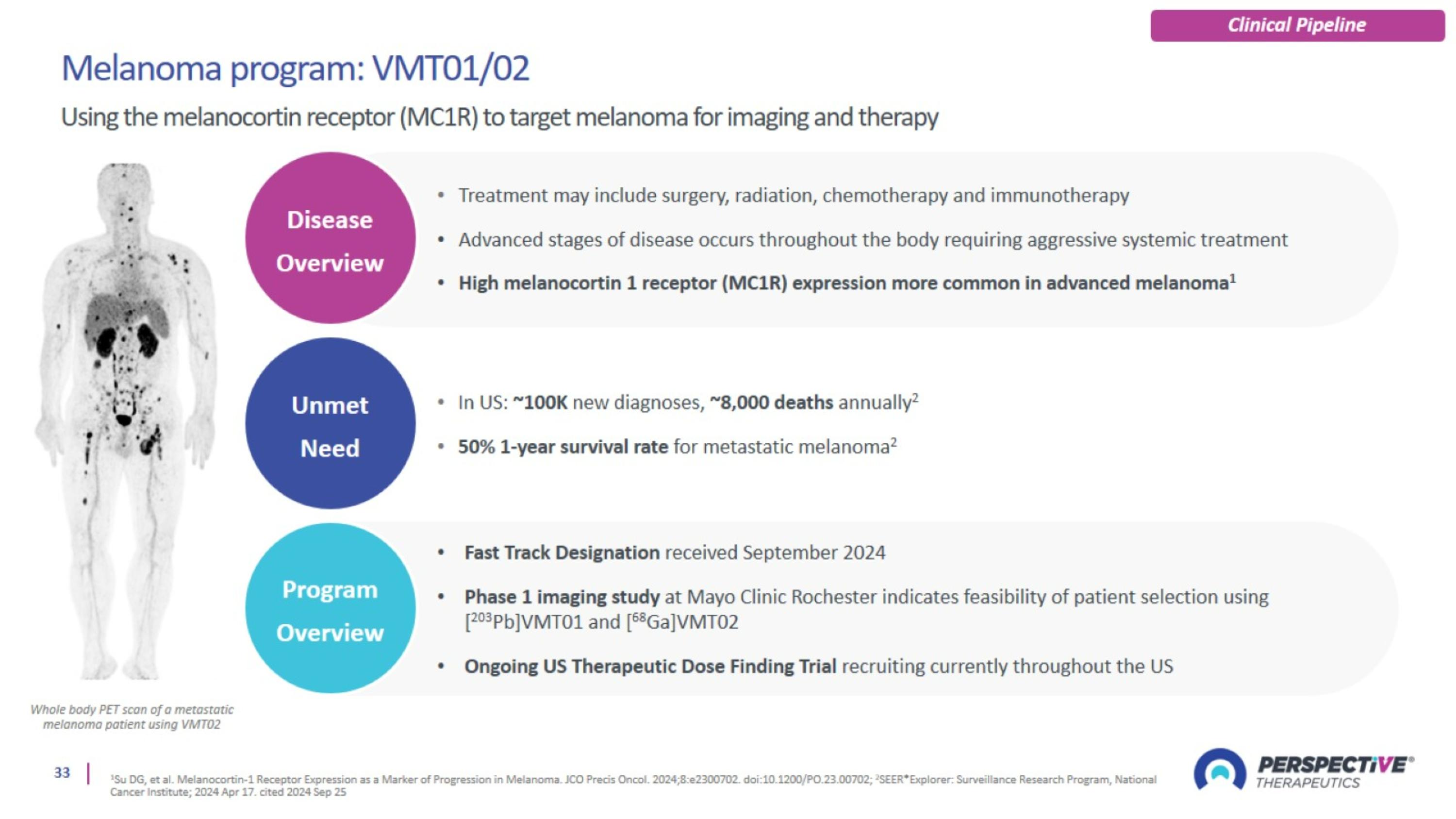 Slide 33