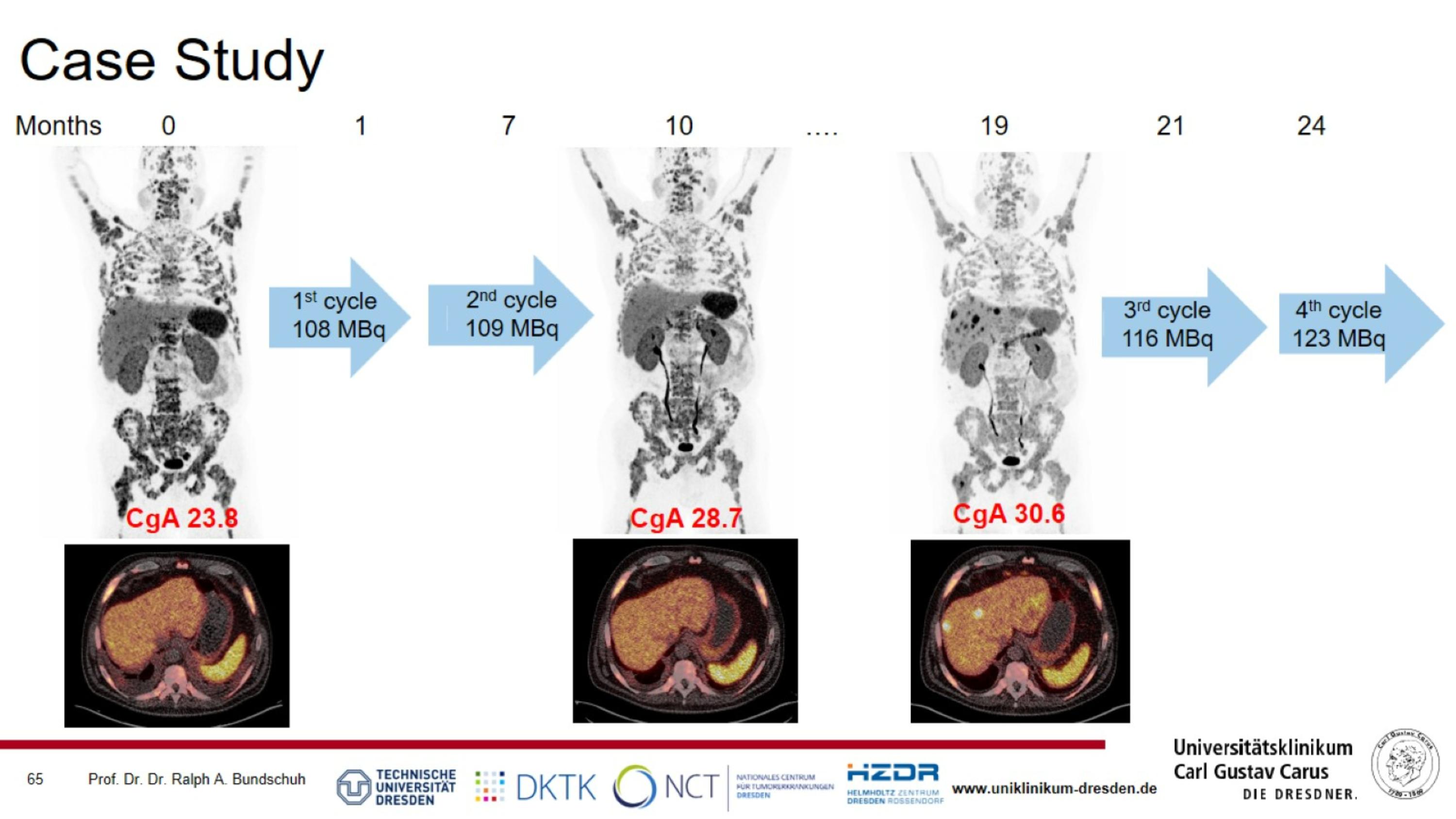 Slide 65
