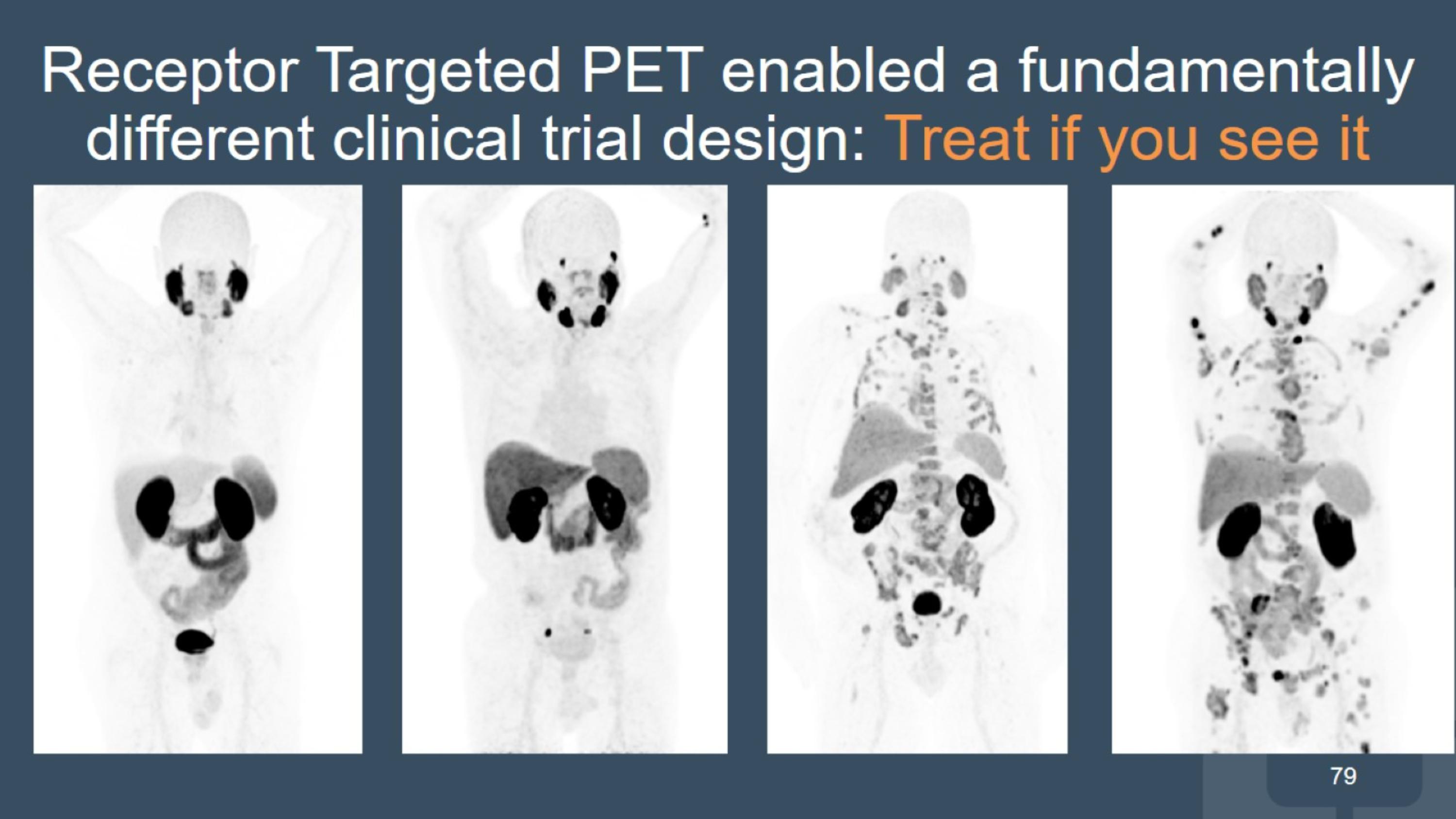 Slide 79