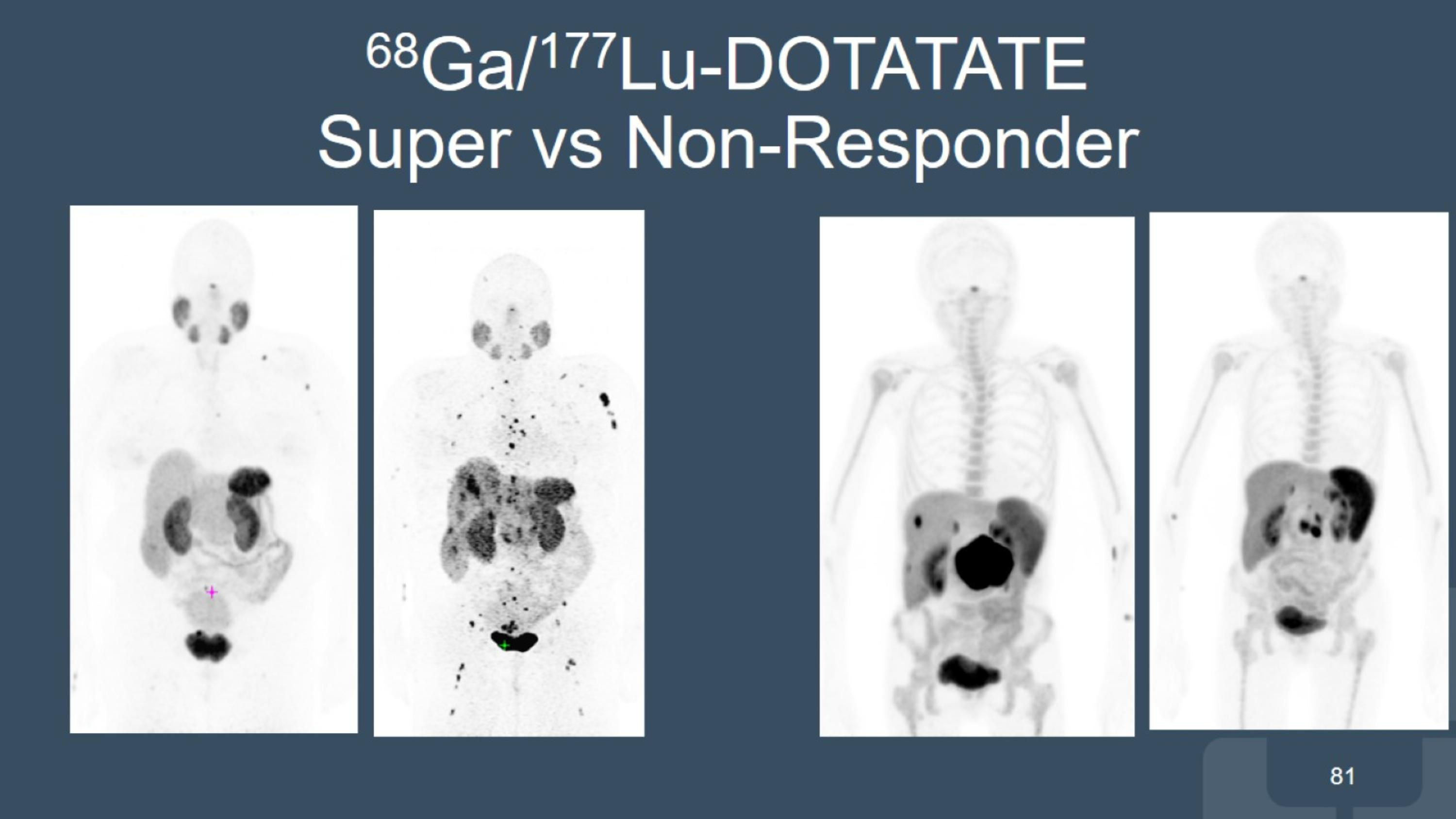 Slide 81