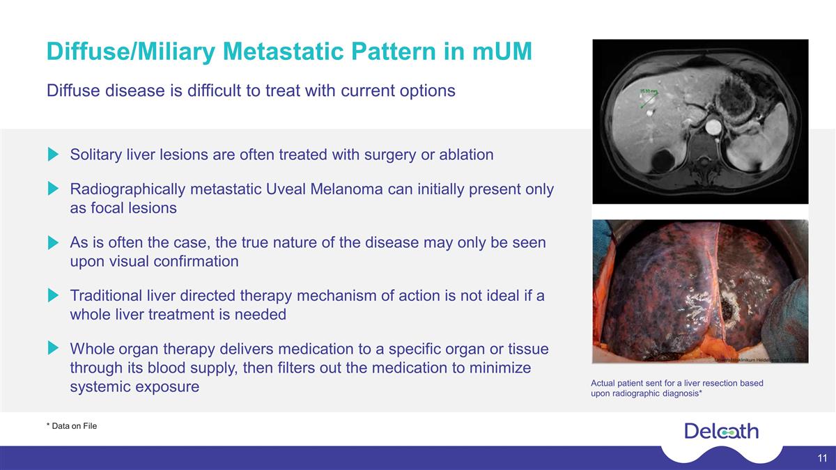 Slide 11