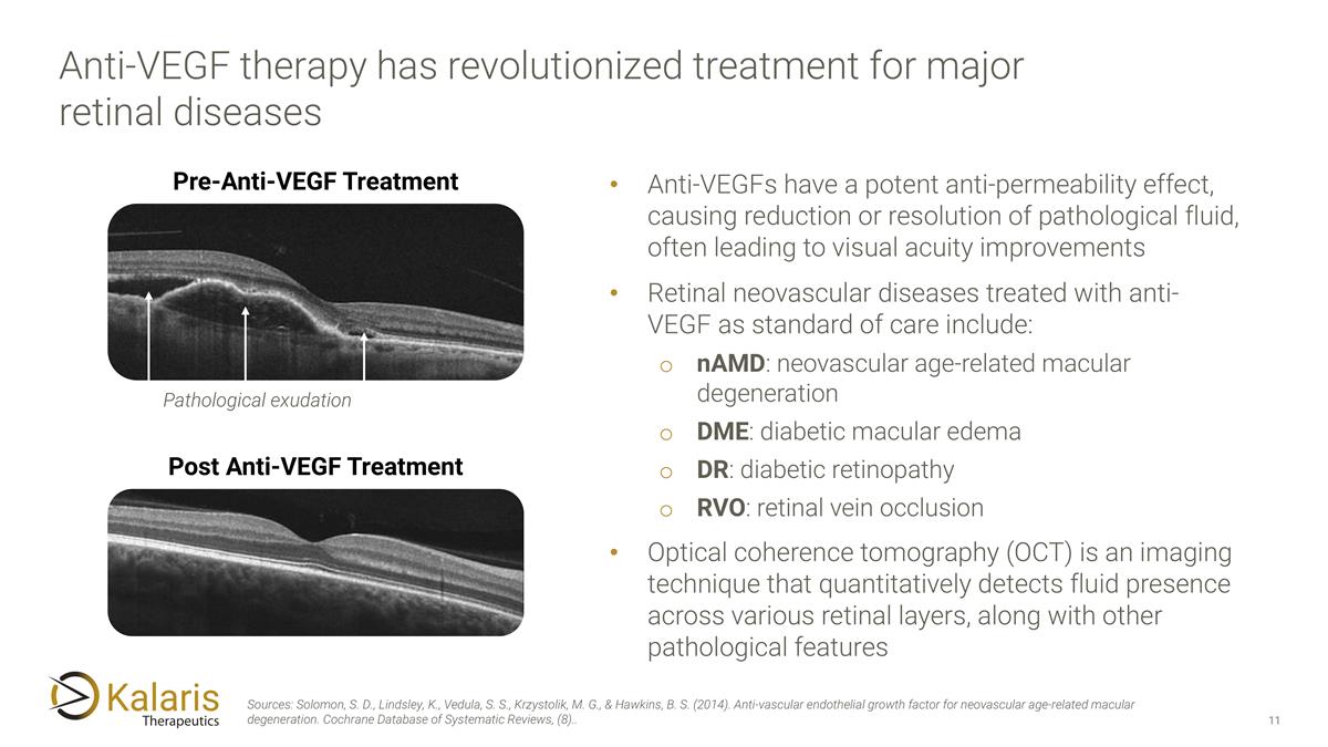 Slide 11