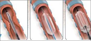 A close-up of a tube

Description automatically generated