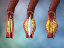 Close-up of a person's fingers

Description automatically generated with low confidence