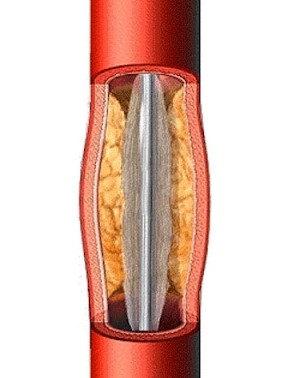 A close-up of a fire extinguisher

Description automatically generated with medium confidence