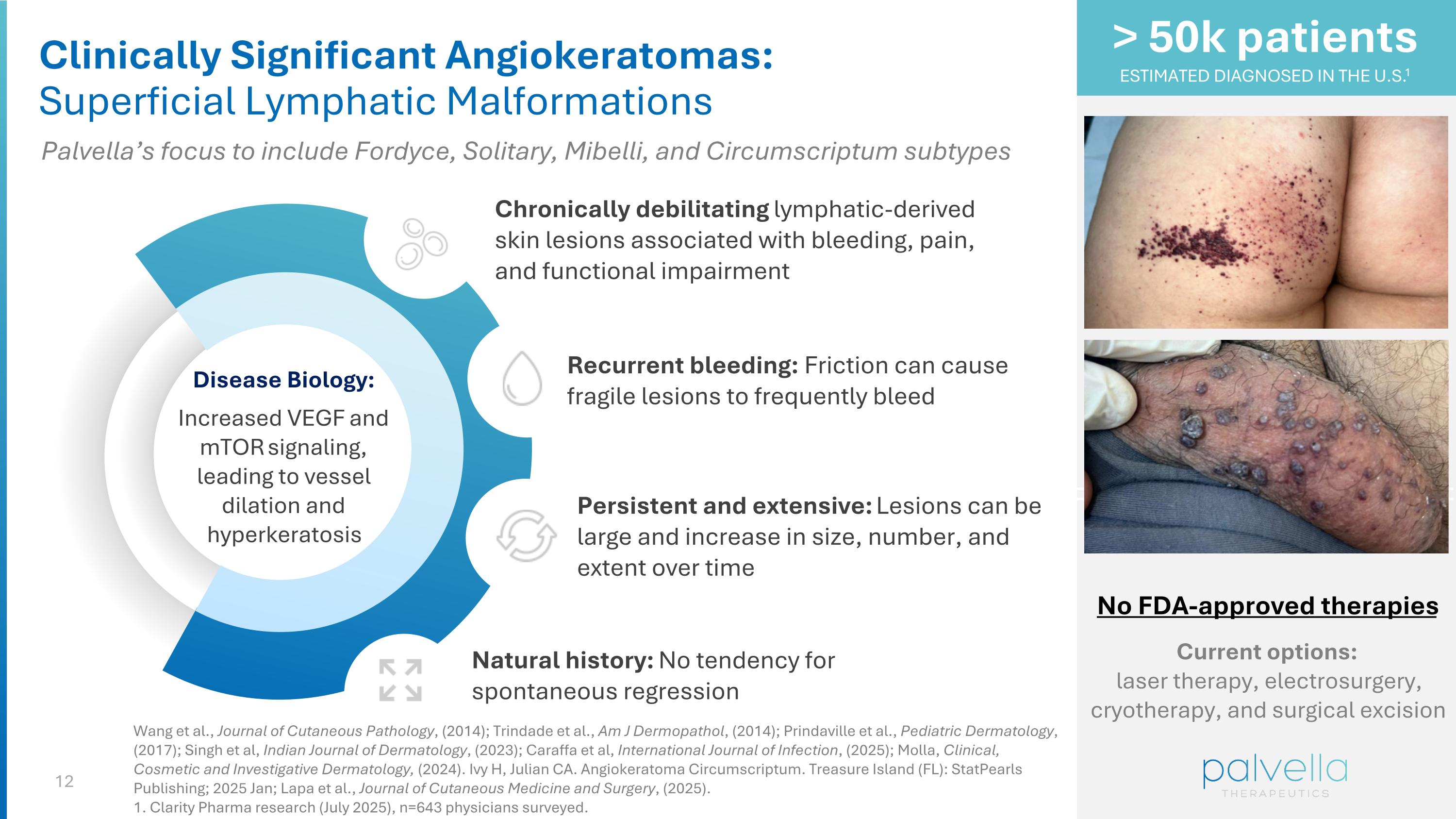 Slide 12
