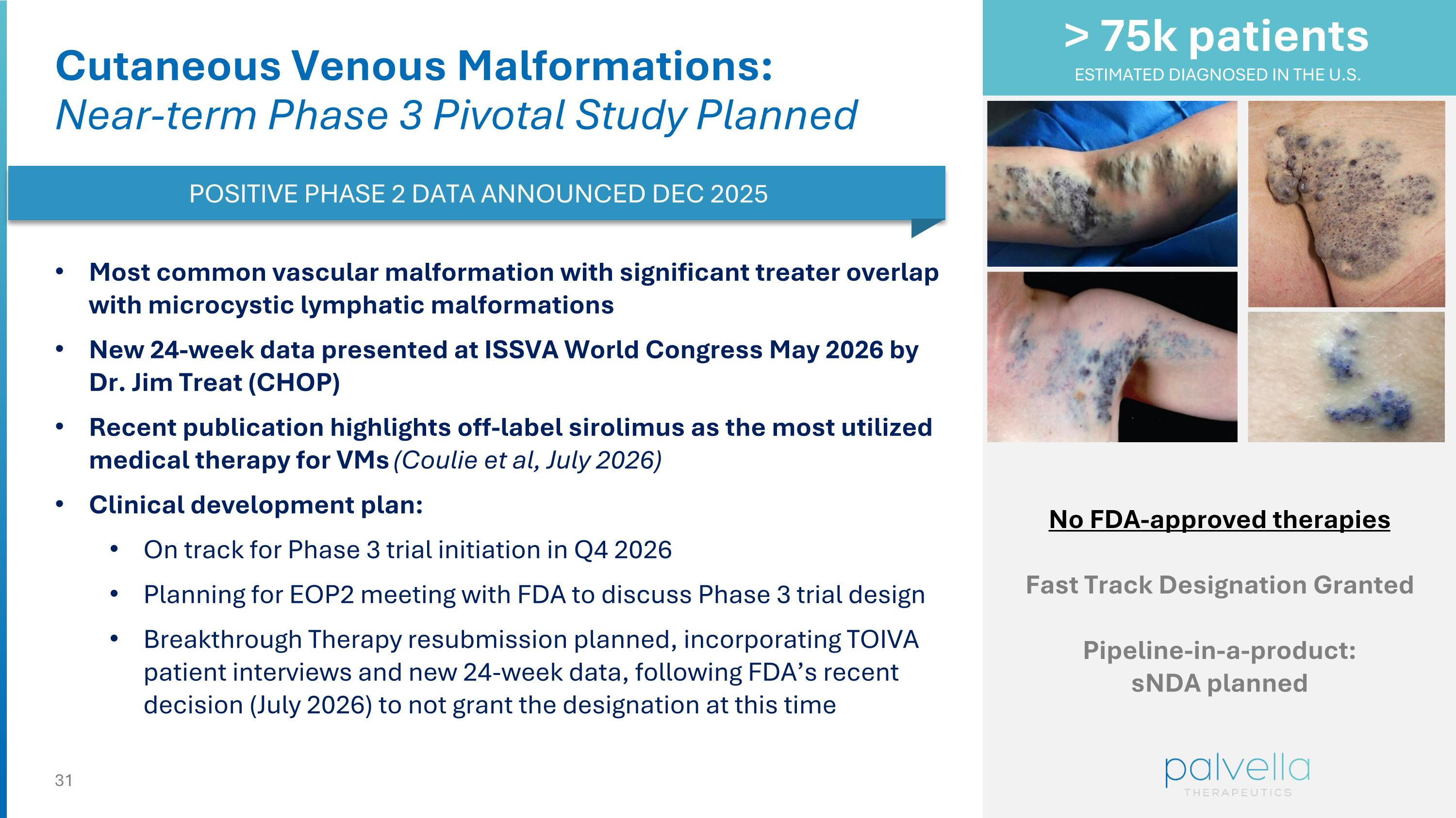 Slide 31