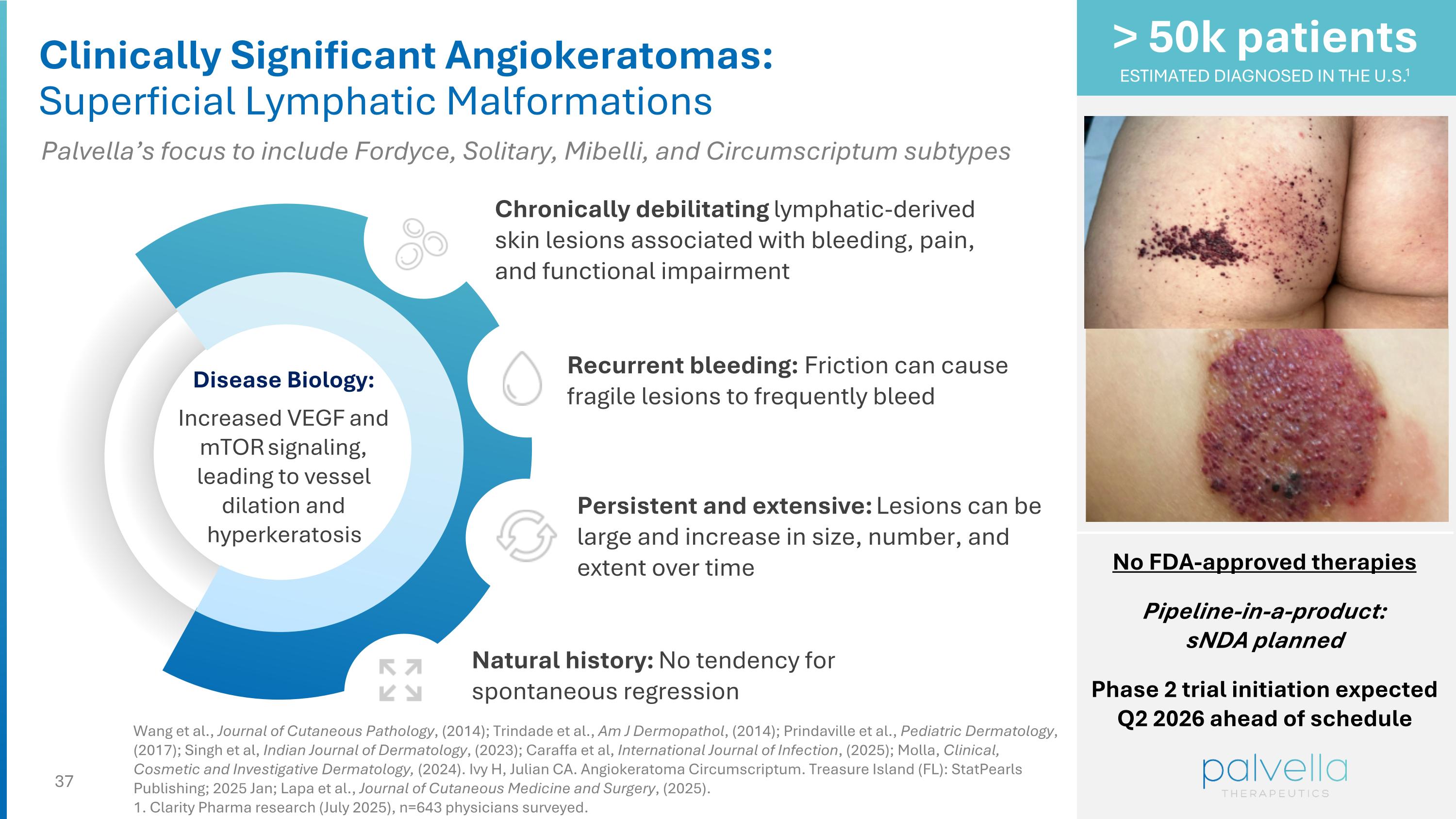 Slide 37
