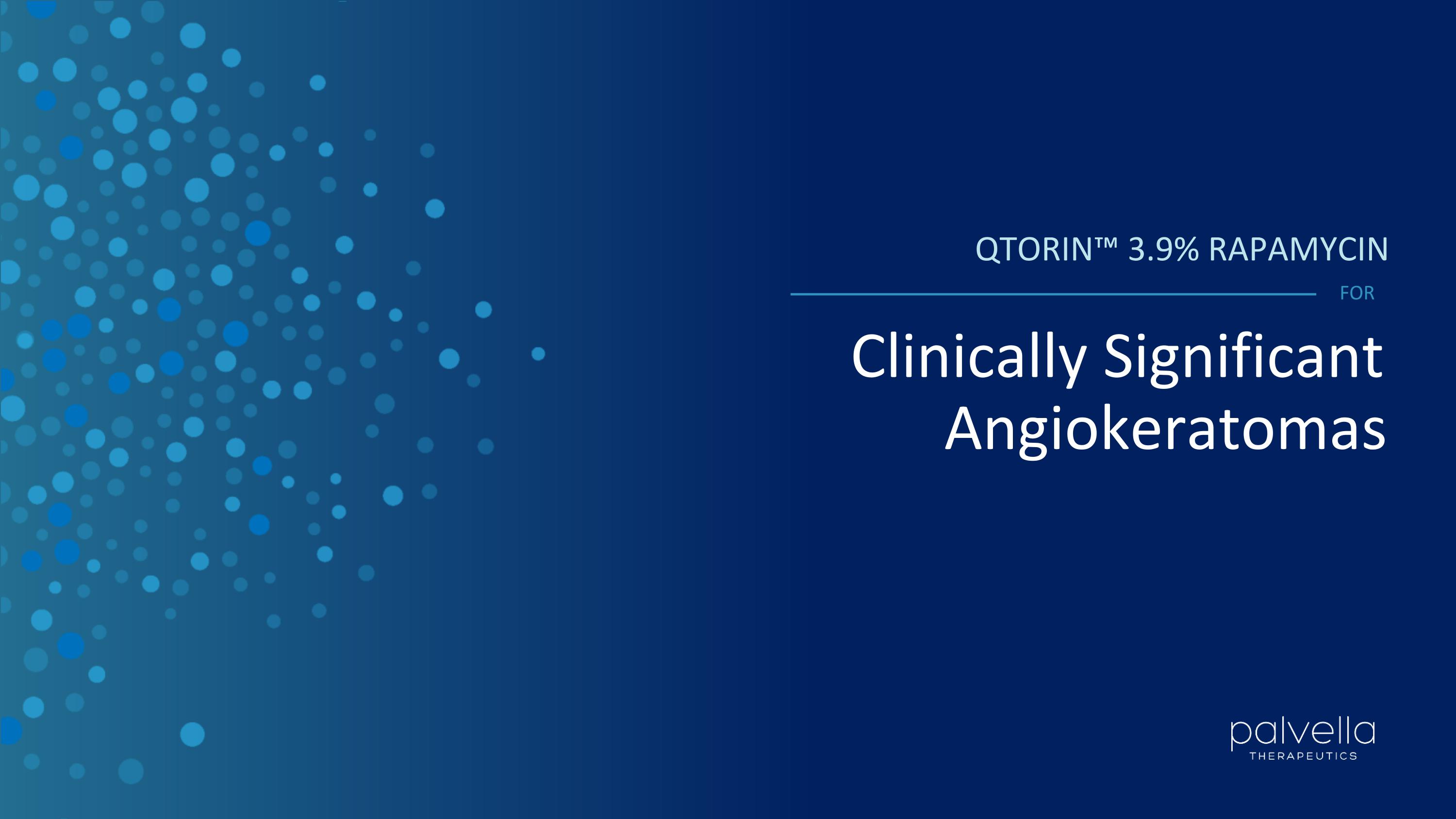 Slide 14