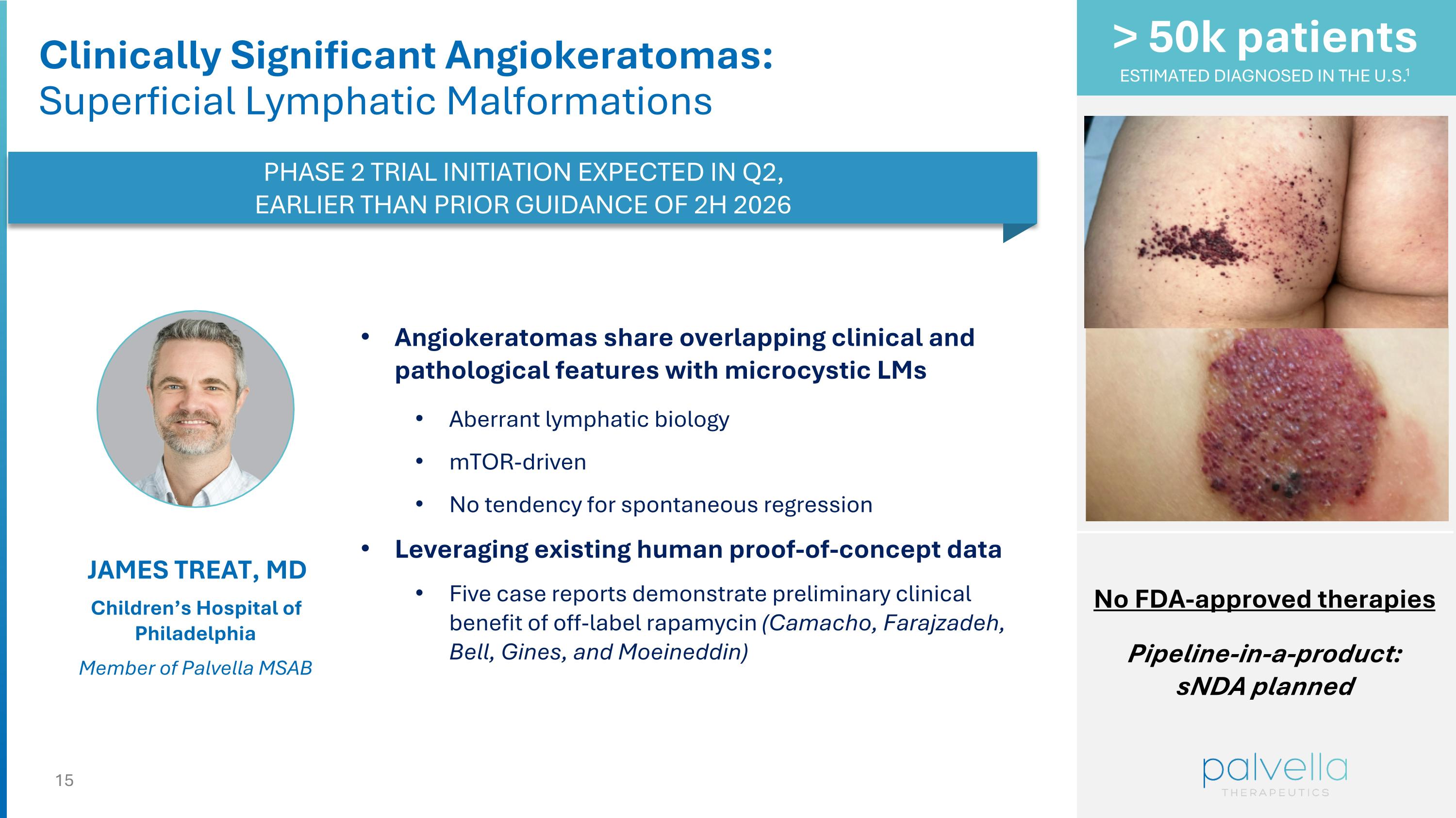 Slide 15