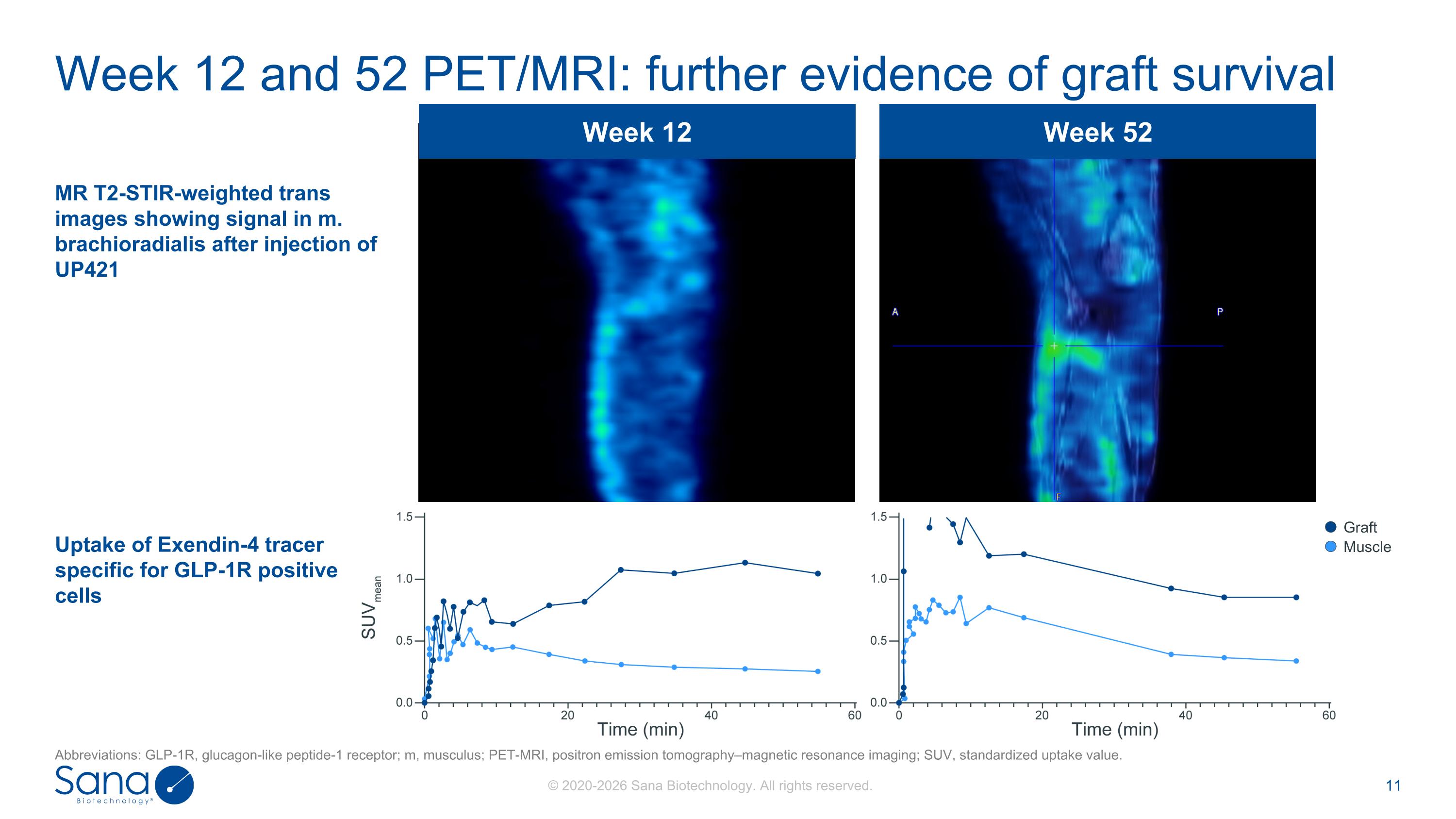 Slide 11