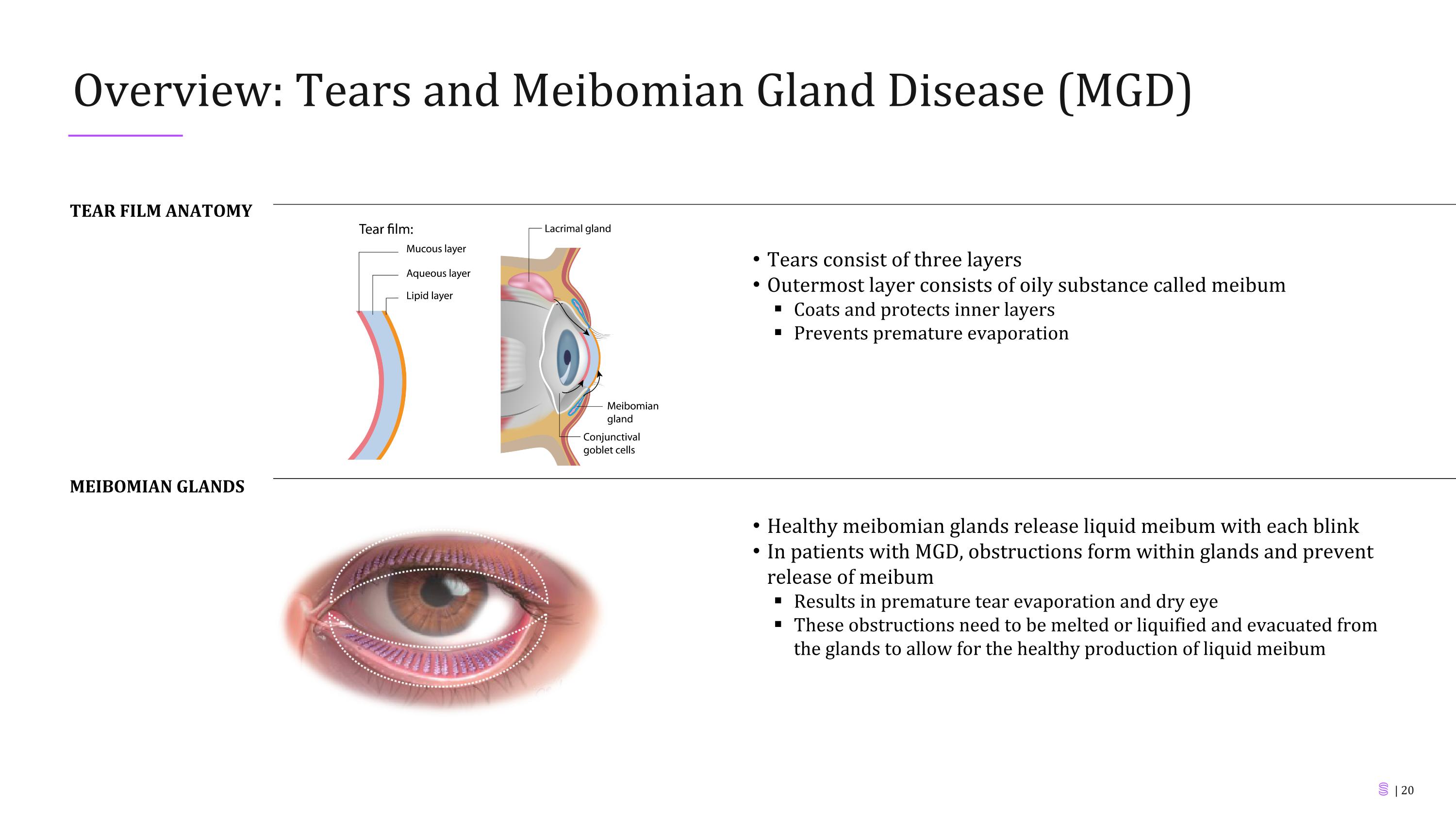 Slide 20
