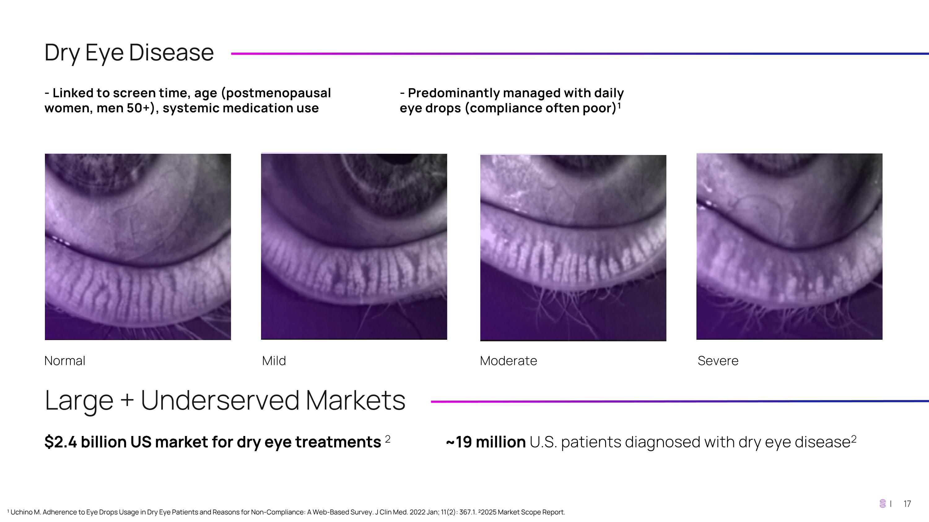 Slide 17