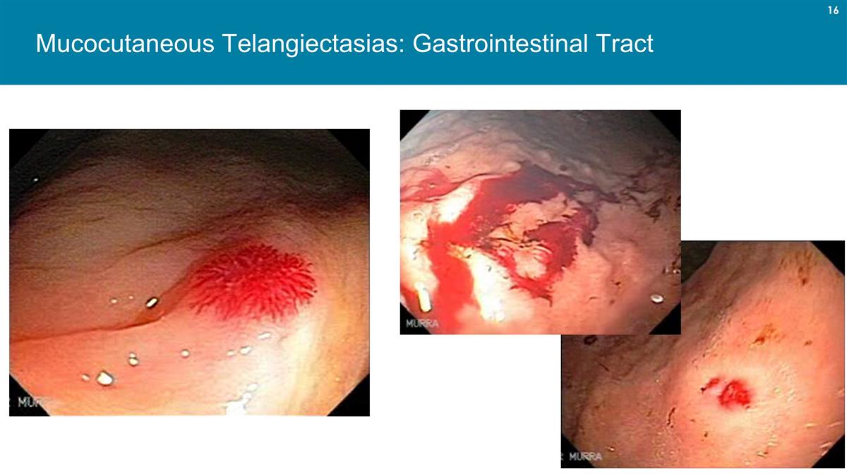 Slide 16