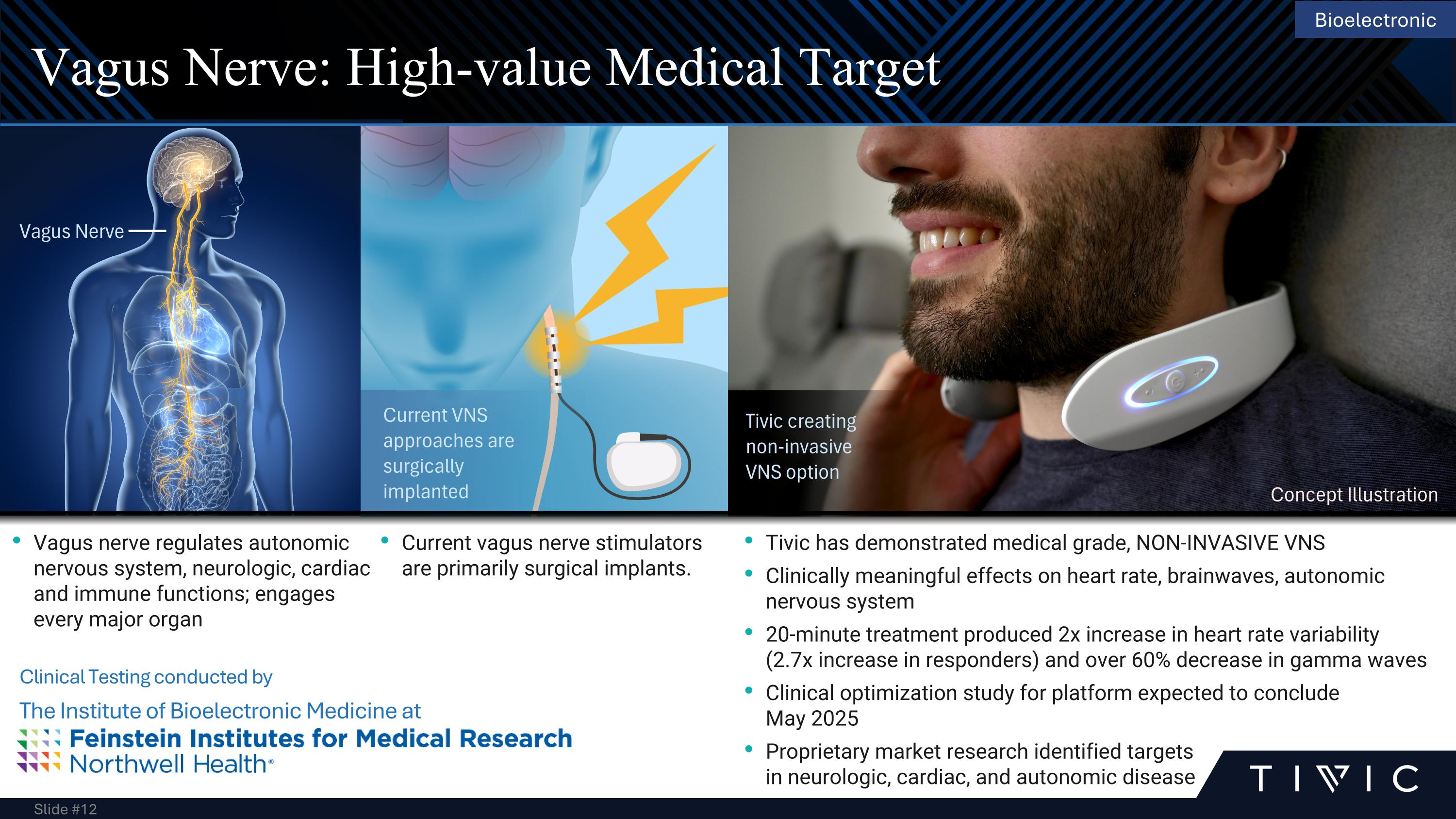 Slide 12